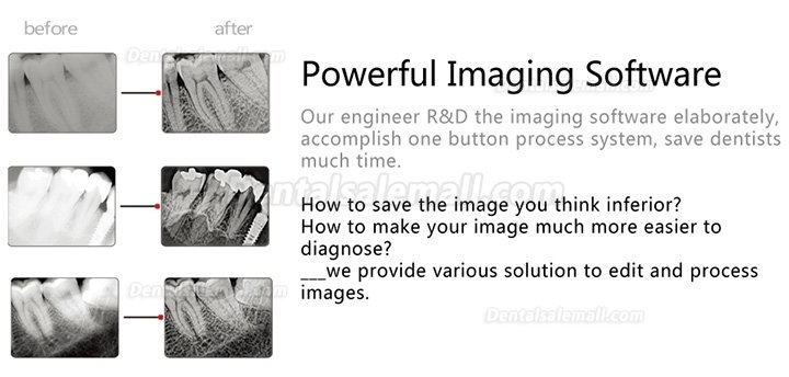 Handy HDR-600 Digital Dental X Ray Sensor Intraoral X-Ray Imaging System